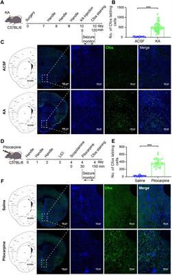 Nucleus accumbens shell modulates seizure propagation in a mouse temporal lobe epilepsy model